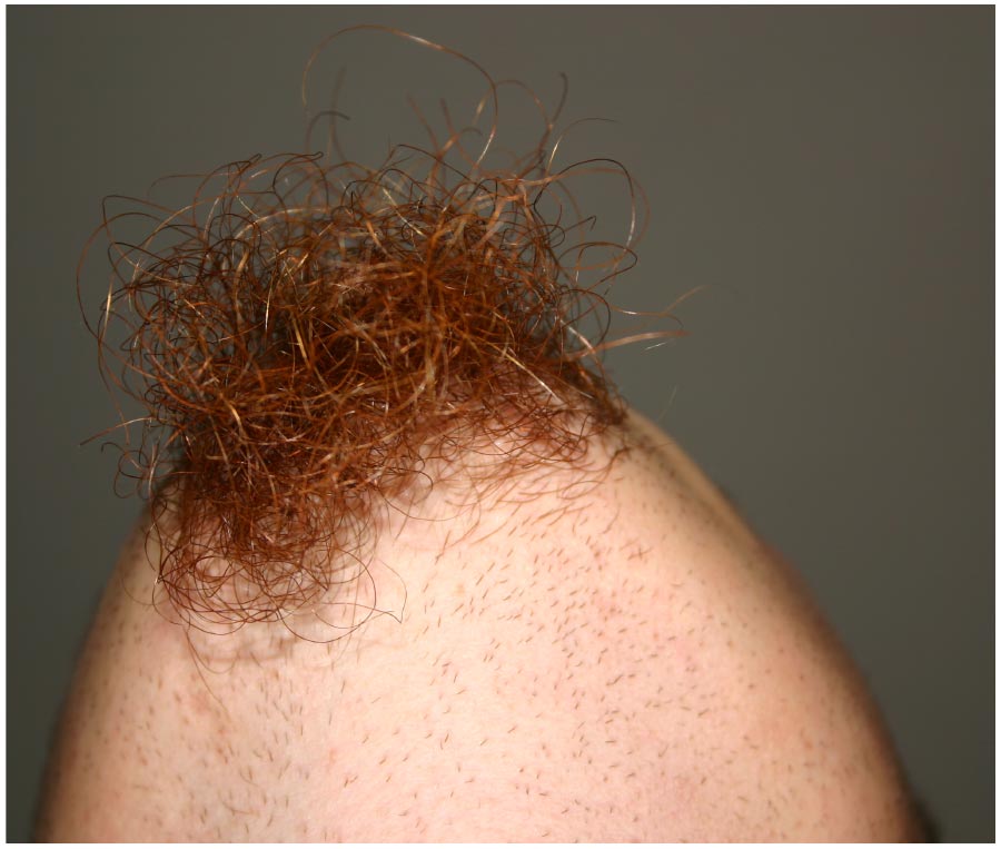 Rote Scharmhaare Rote Scharmhaare