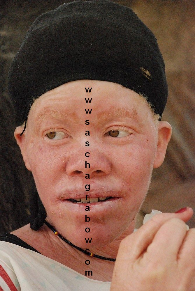 Albino Herero Woman