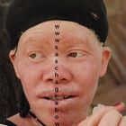 Albino Herero Woman