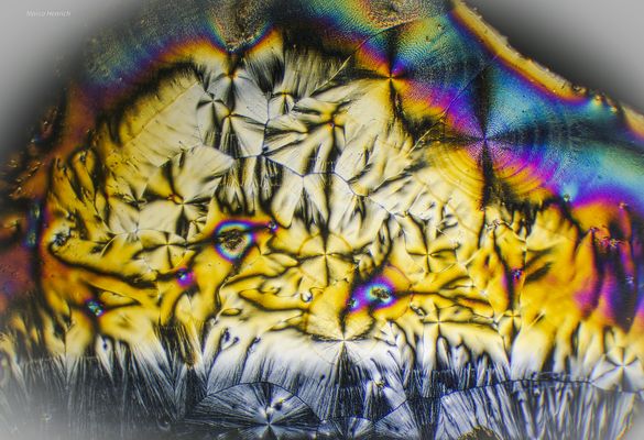 Ascorbinsäure unter Mikroskop