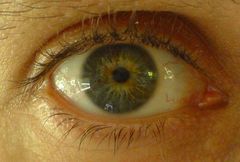 auge_02