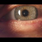 Augen - Closeup - erste Gehversuche mit Diopter-Filtern