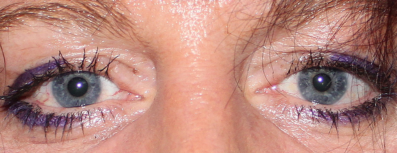 Augen Foto Blick Foto Bild fotos von teilen des Augen Foto Blick Foto Bild fotos von teilen des