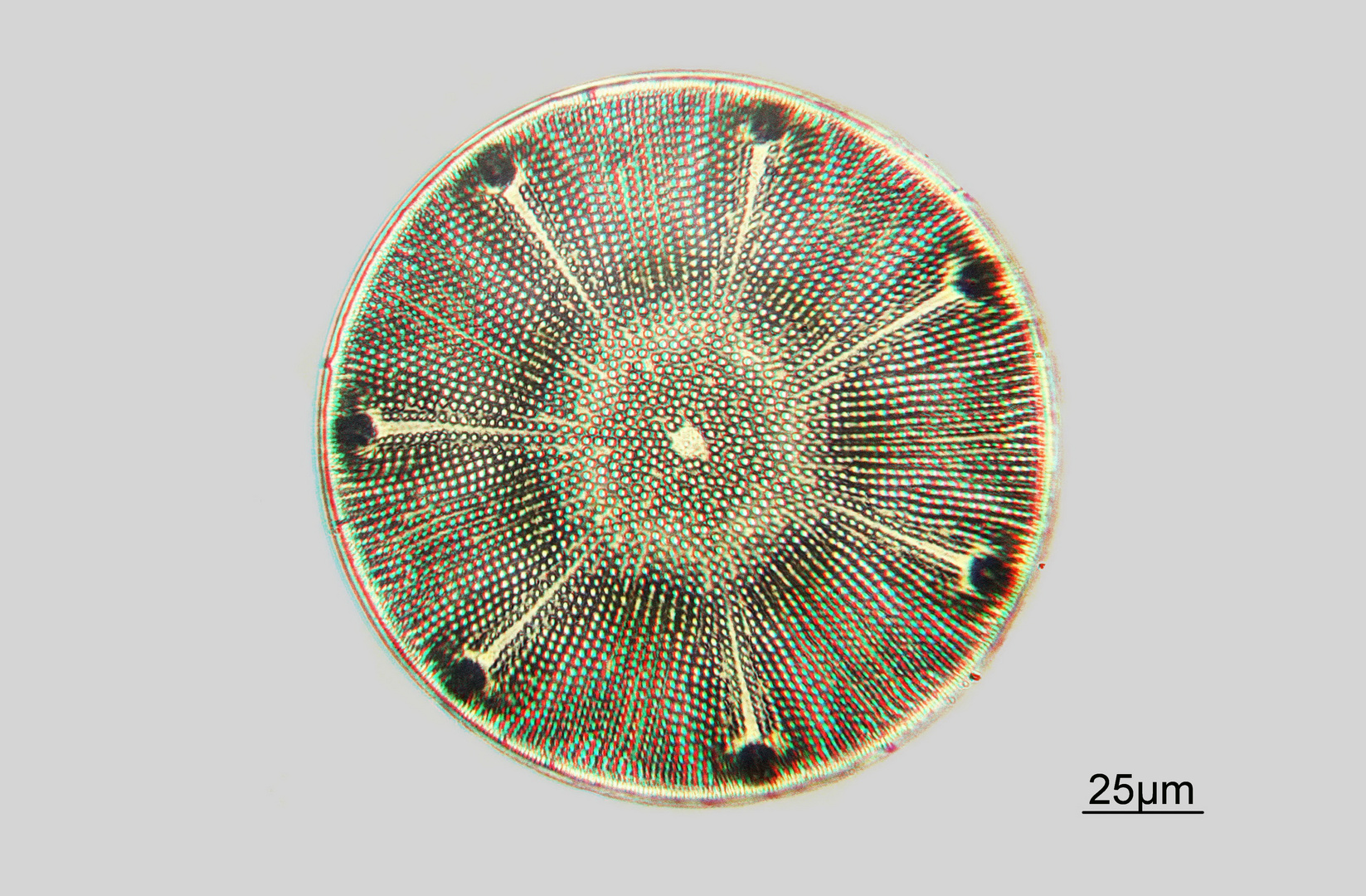  Aulacodiscus spec. in 3D