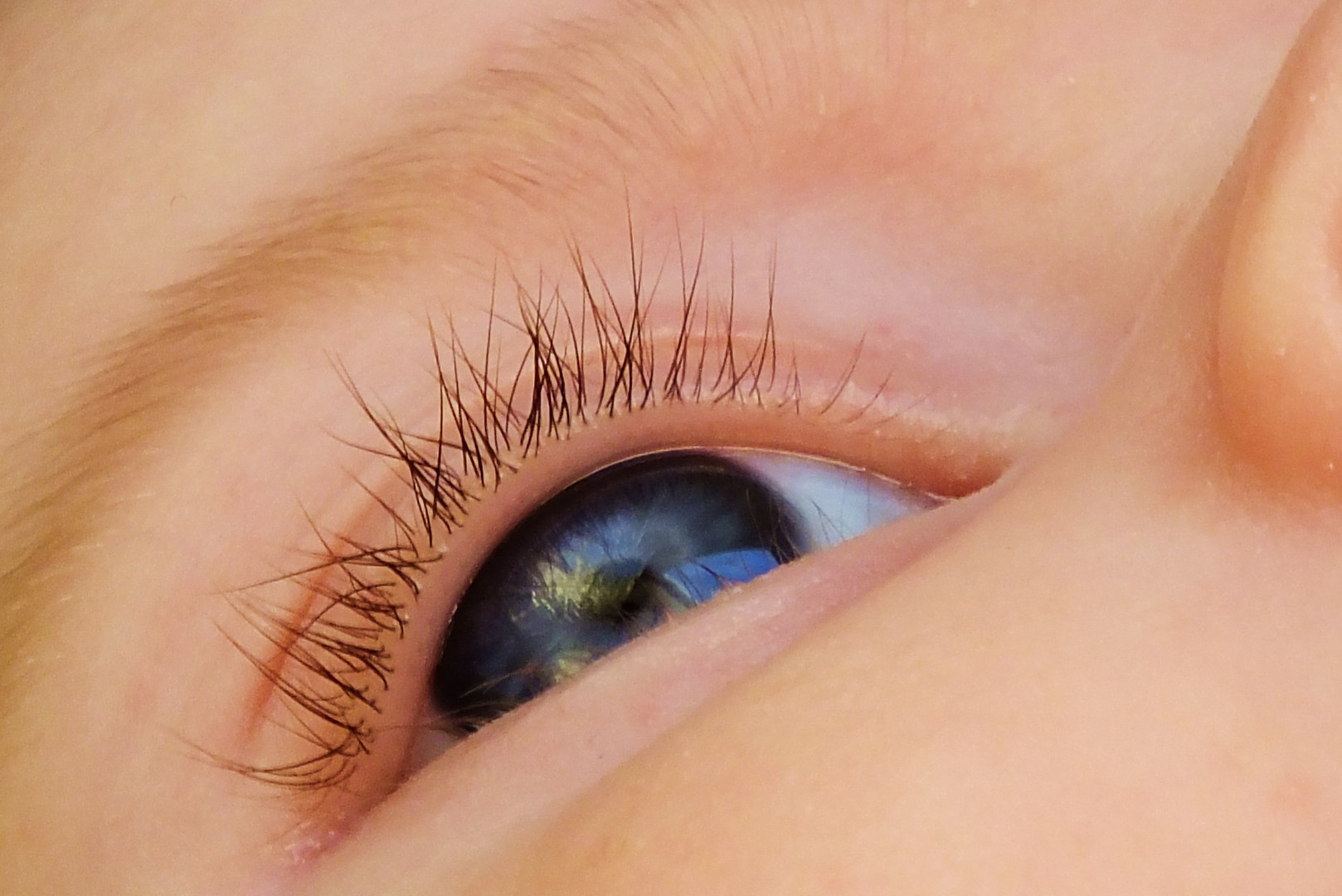 baby`s eye