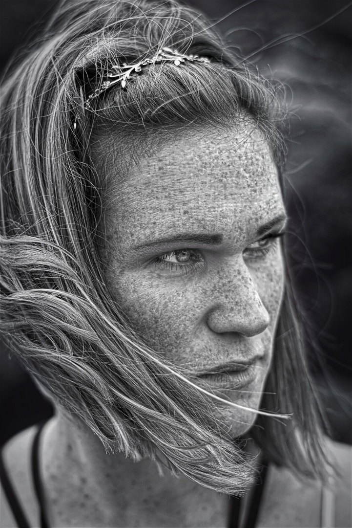 Beauty of the Freckles