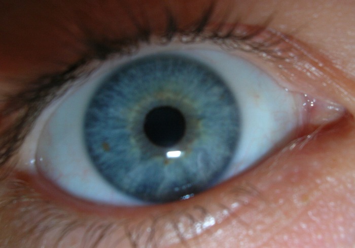 blue eye