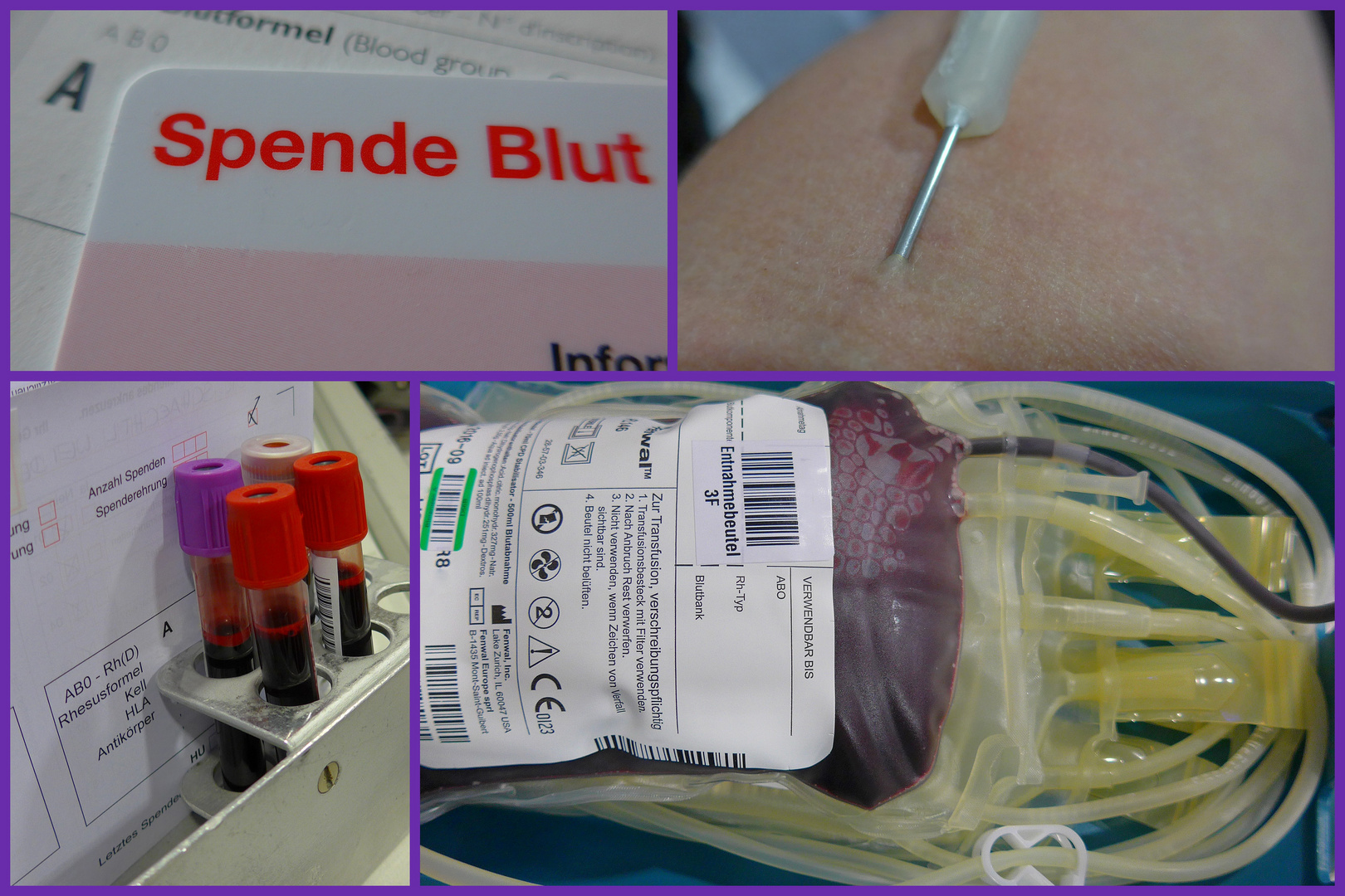 BLUT