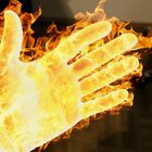 Burning hand