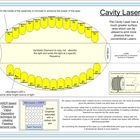 Cavity Laser