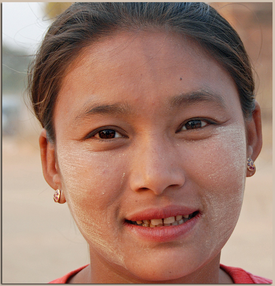 cosmetic (medicine) of Choice in Myanmar