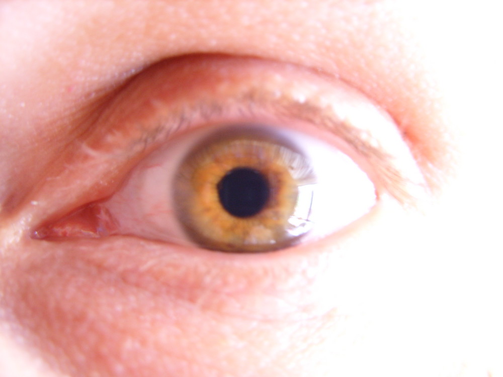 das Auge 1