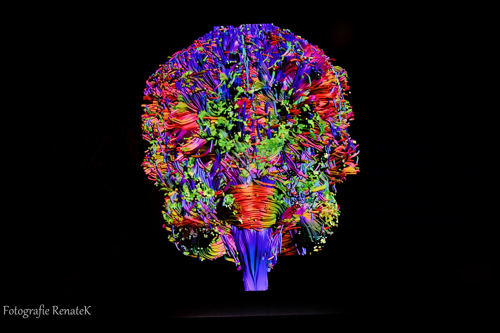 Das Nervensystem des Gehirns - Ansicht von hinten -