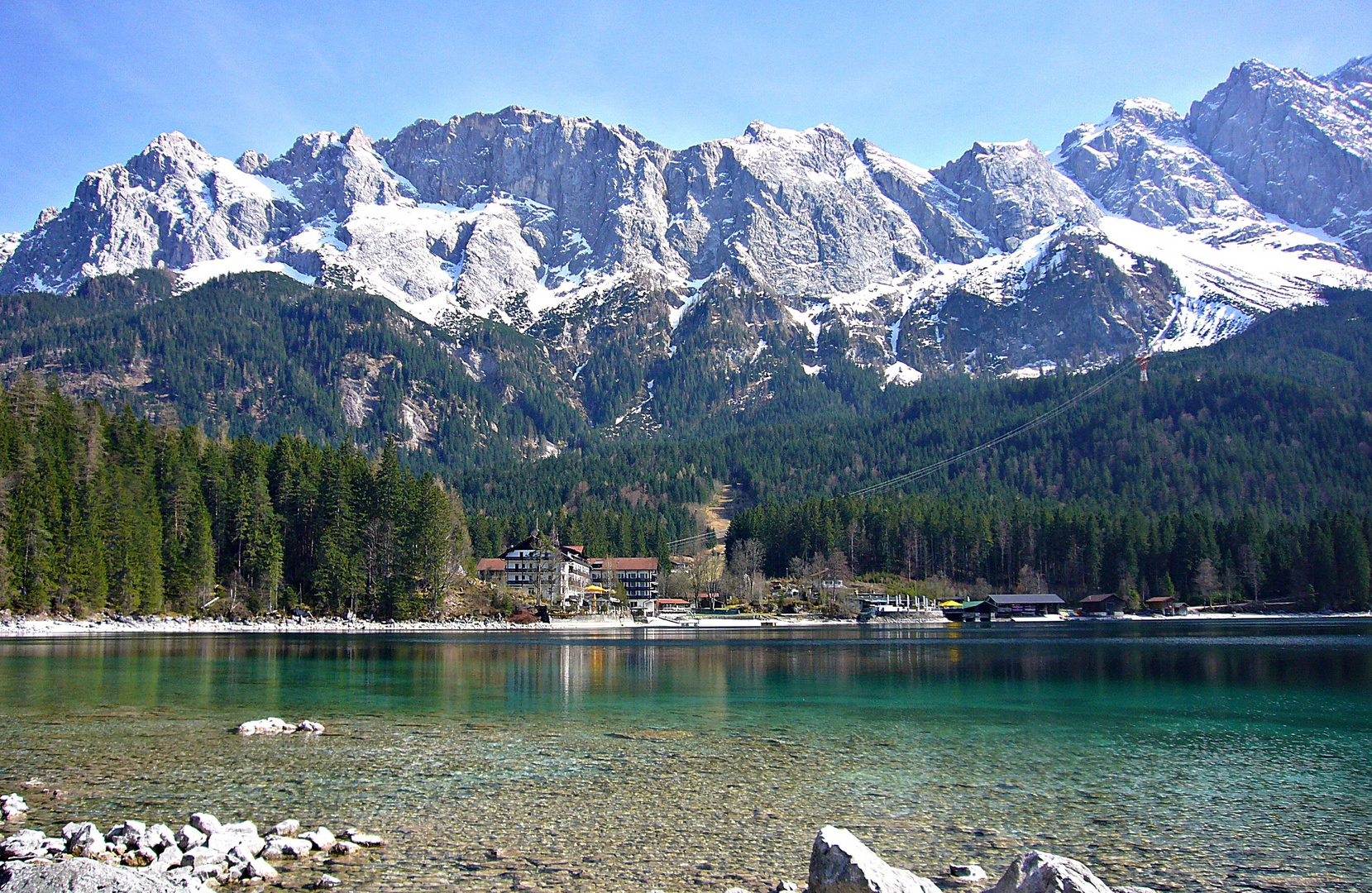 Der Eibsee 1