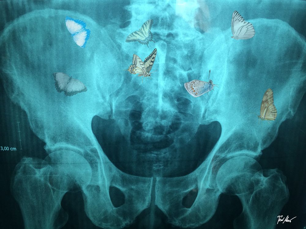 Diagnose: Schmetterlinge im Bauch / Diagnosis: Butterflies in stomach