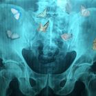 Diagnose: Schmetterlinge im Bauch / Diagnosis: Butterflies in stomach