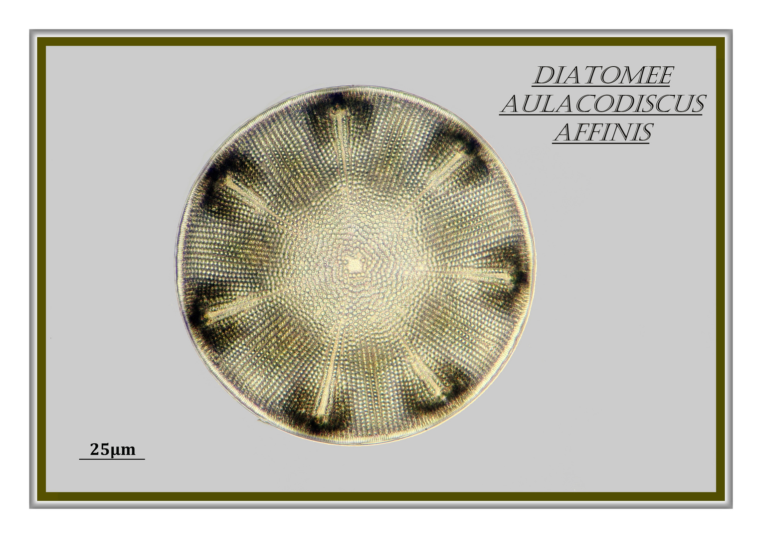 Diatomee Aulacodiscus spec.