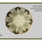 Diatomee Aulacodiscus spec.