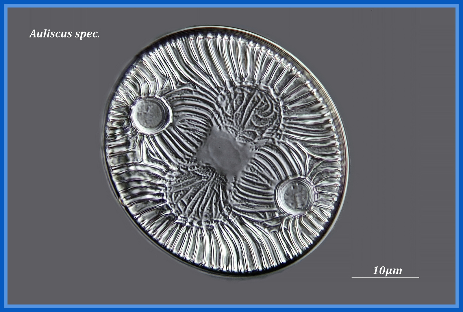 Diatomee Auliscus spec. fossil