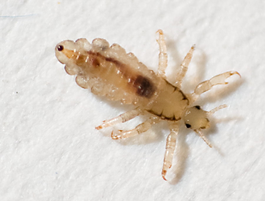 die gemeine Kopflaus Foto & Bild sonstiges Bilder auf