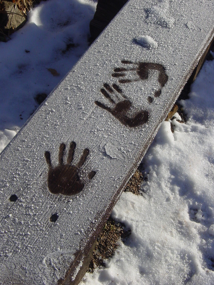 Die Hände im Winter