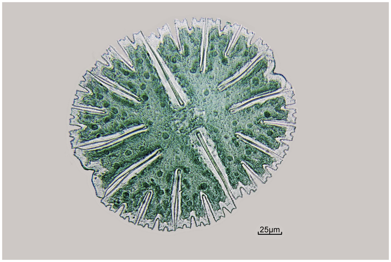 Die Radalge Micrasterias rotata