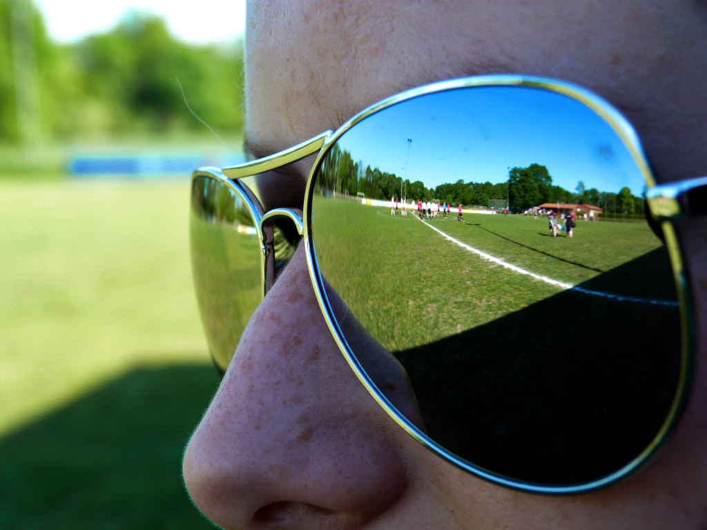 Die Sommersprossenbrille