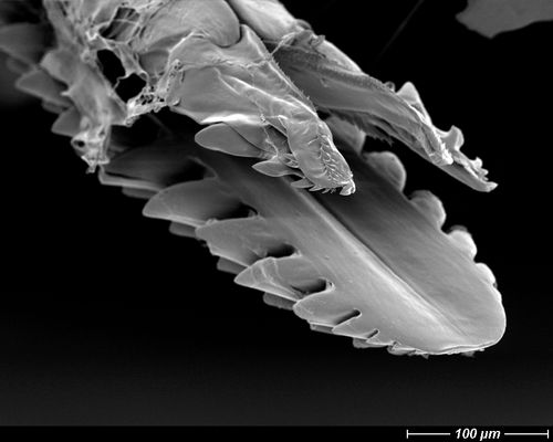 Dieses Ding steckte letztens noch in meiner Schulter (3)