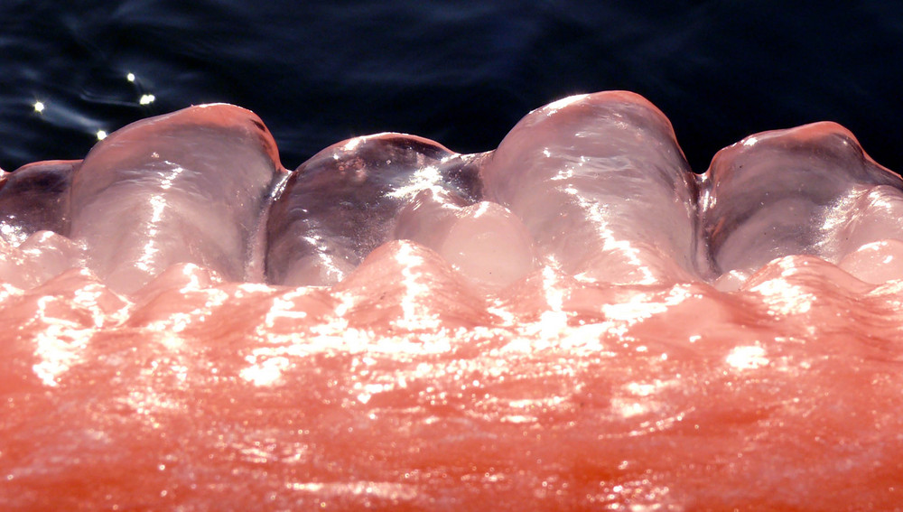 Eiskalte Zähne