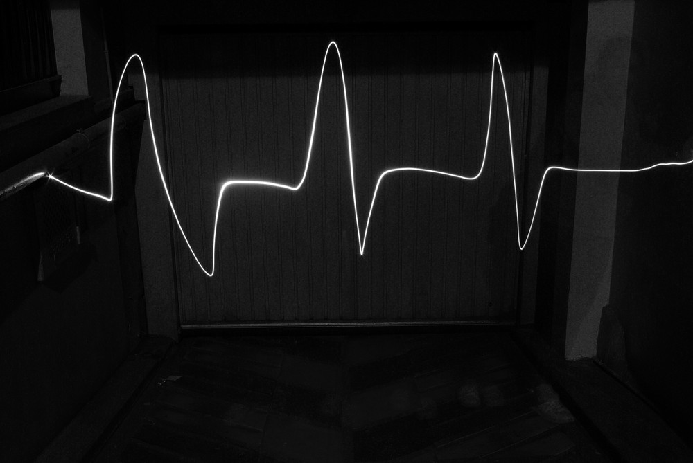 electrocardiogramme