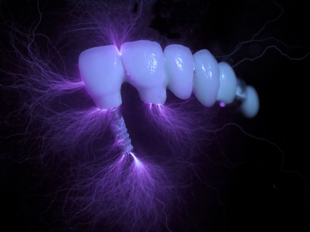 Energy in teeth