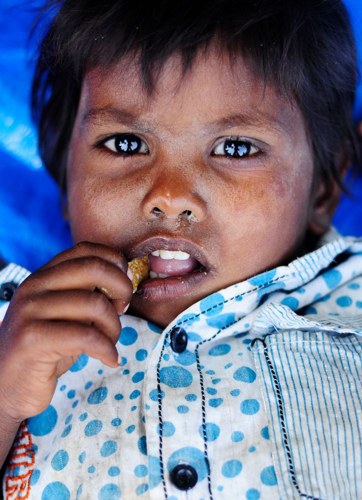 Erkältung, Fieber, Hunger - Slumkid in Goa