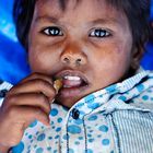 Erkältung, Fieber, Hunger - Slumkid in Goa