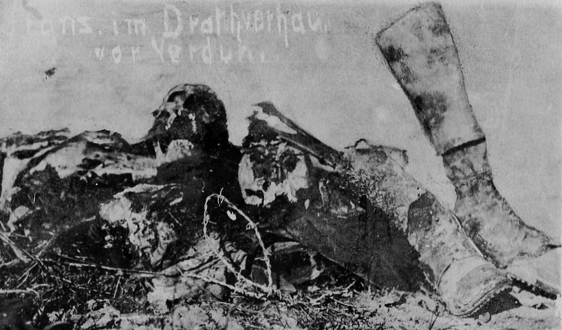 Erster Weltkrieg 13: Im Drahtverhau vor Verdun