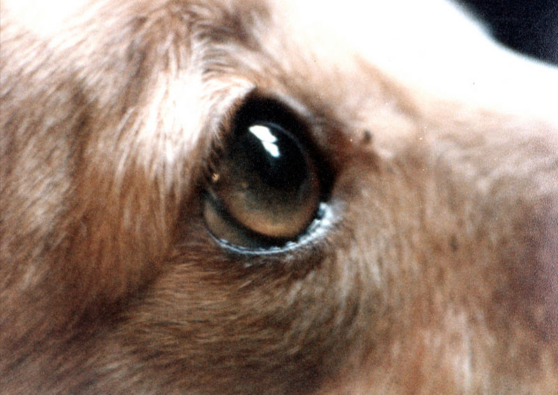 Eye