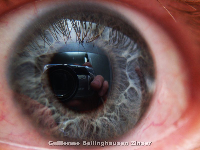 Eye macro