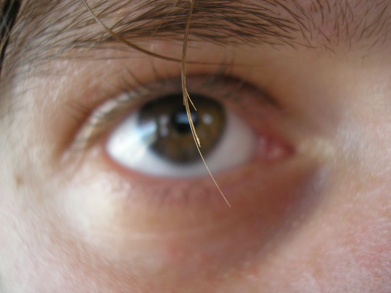 Eye :) :P My eye :)