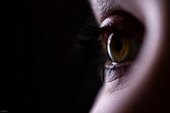 eyecatcher 