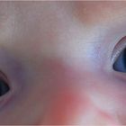 Eyes of a child