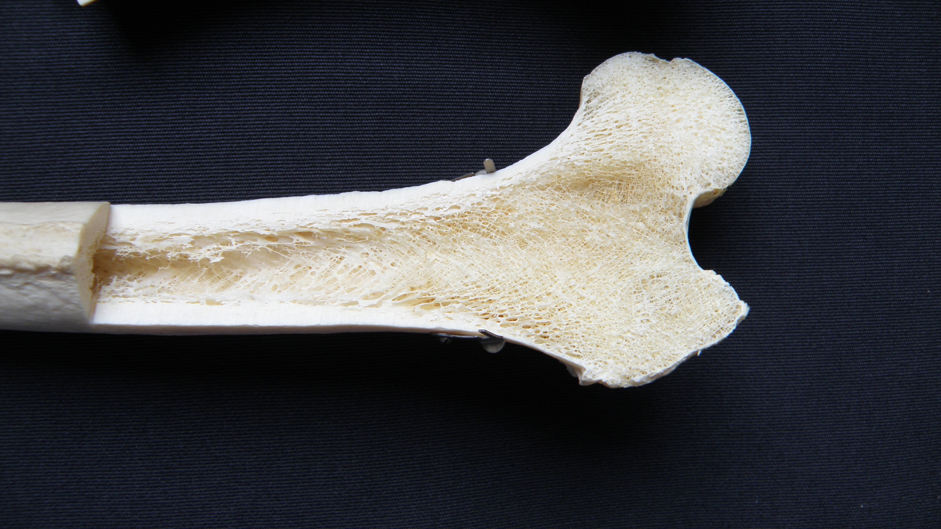 femur