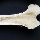 femur