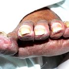Five old sweet toes (oder Großmutter von anterior inferior)