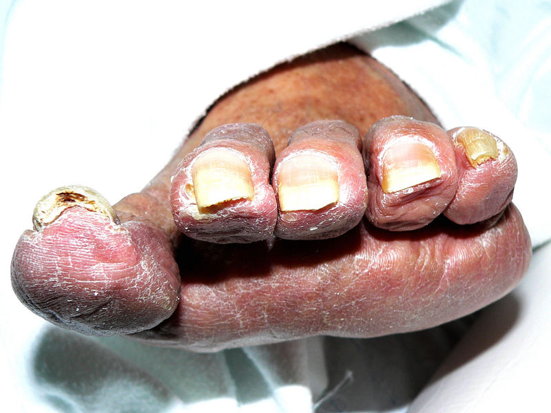 Five old sweet toes (oder Großmutter von anterior inferior) by A G.