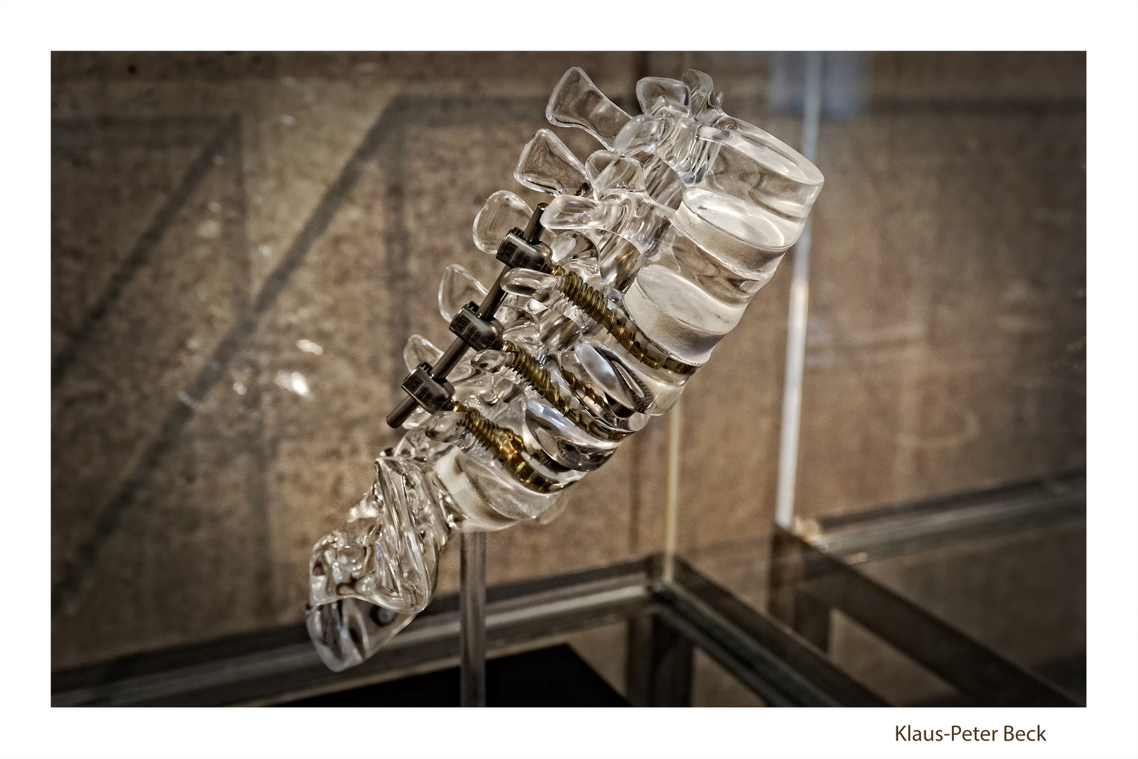 Fixateur Foto & Bild industrie und technik, technikdetails