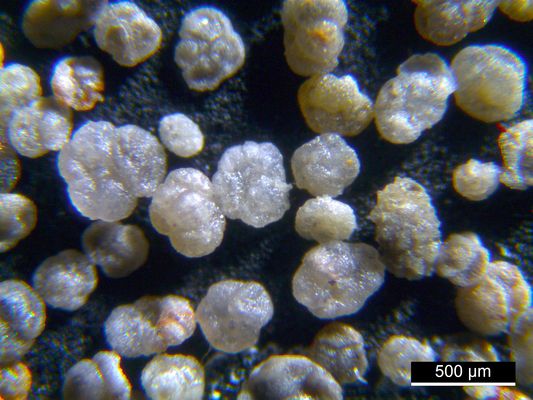 Foraminiferen aus der Kreidezeit - Unteres Turonium