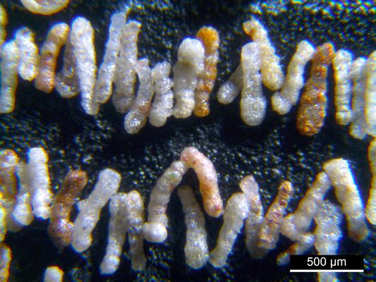 Foraminiferen aus der Kreidezeit - Unteres Turonium