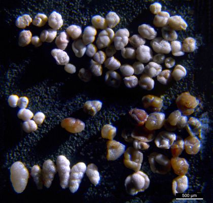 Foraminiferen aus der Kreidezeit - Unteres Turonium