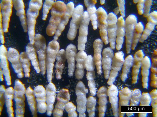 Foraminiferen aus der Kreidezeit - Unteres Turonium