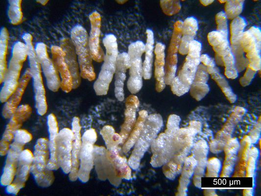 Foraminiferen aus der Kreidezeit - Unteres Turonium