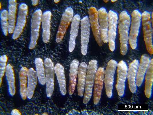 Foraminiferen aus der Kreidezeit - Unteres Turonium